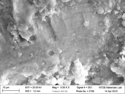 Figure 4: SEM micrographs of the inboard bracket fracture surface. (right)